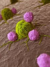 FDA Updates REMS for CAR T-Cell Therapies 