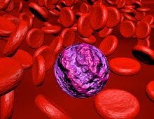  FDA Approves Tibsovo Combination for Older Patients with Leukemia
