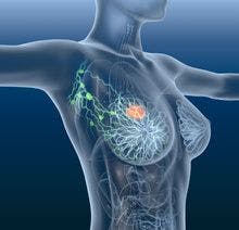 FDA Approves Lynparza for Early Breast Cancer