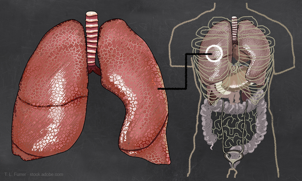 Self-injectable respiratory medication opens doors for patients with severe asthma