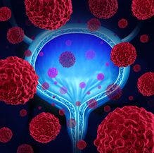 FDA Approves First Gene Therapy for Bladder Cancer 