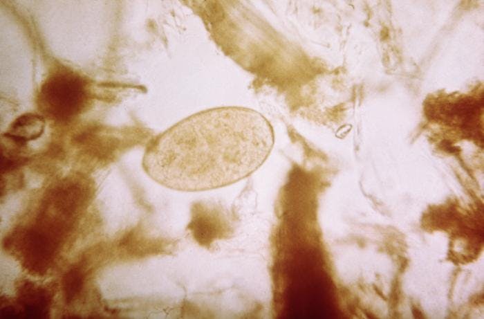 This image shows the egg of Fasciola hepatica, one of two species of parasitic flatworms. Infections caused by these parasites can lead to fever, abdominal pain, nausea, and diarrhea. 

Photo credit: CDC