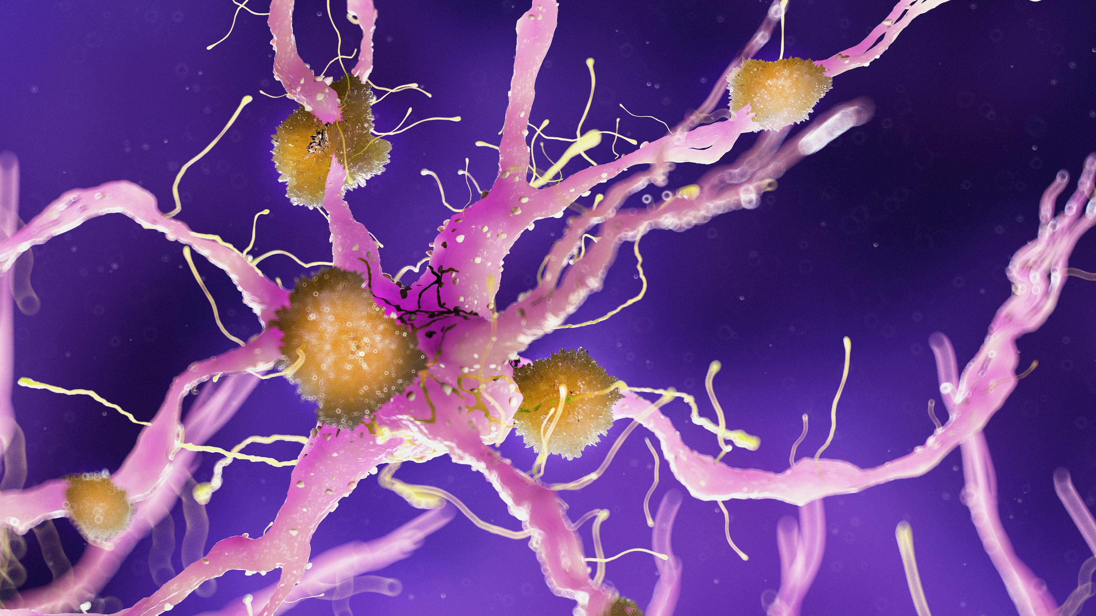 FDA Decision on Donanemab for Alzheimer’s Expected by End of Year