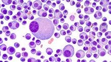  Janssen Submits BLA for Another Bispecific Antibody for Multiple Myeloma